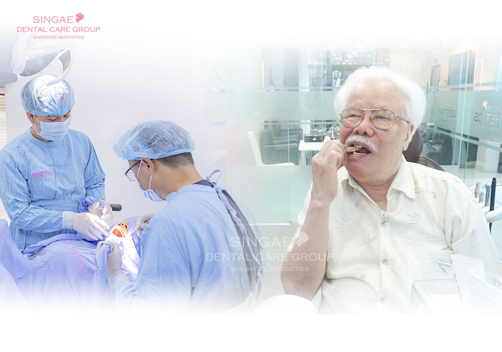Trồng răng Implant SSI – dịch vụ được nhiều khách hàng quan tâm nhất tại phòng khám nha khoa Singae Dental